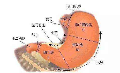 浅表性胃炎