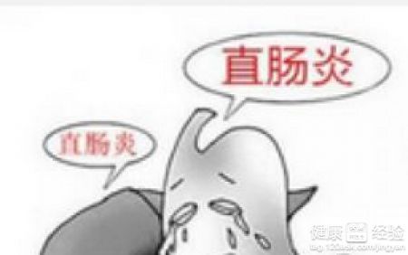 预防直肠炎