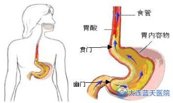 胃酸