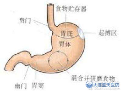 萎缩性胃炎