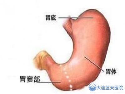 胃窦炎