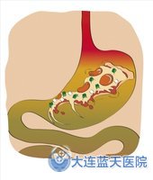 胃溃疡的起因是胃炎吗？