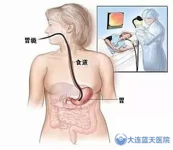 大连广誉远医院内镜检查，你准备好了吗？