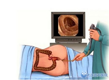 大连广誉远医院内镜检查，你准备好了吗？