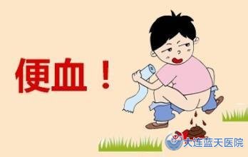 大连胃肠科医院治疗直肠炎的方法有哪些？