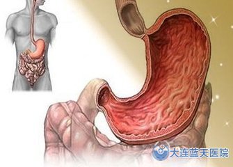 大连胃肠科医院如何检查胃窦炎呢？